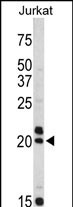 Rabbit Polyclonal Antibody to VIP