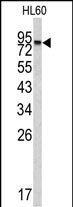 Rabbit Polyclonal Antibody to CPXM2 (N-term)