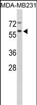 Rabbit Polyclonal Antibody to CTSF (Center D276)