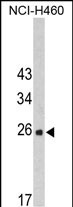 Rabbit Polyclonal Antibody to FKBP14 (N-term)