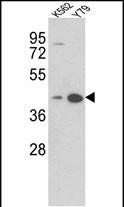 Rabbit Polyclonal Antibody to AZGP1 (N-term)