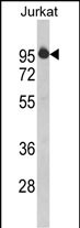 Rabbit Polyclonal Antibody to HTATSF1 (N-term)