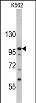 Rabbit Polyclonal Antibody to MTBP