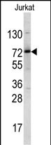 Rabbit Polyclonal Antibody to NKRF