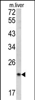 Rabbit Polyclonal Antibody to SPCS3