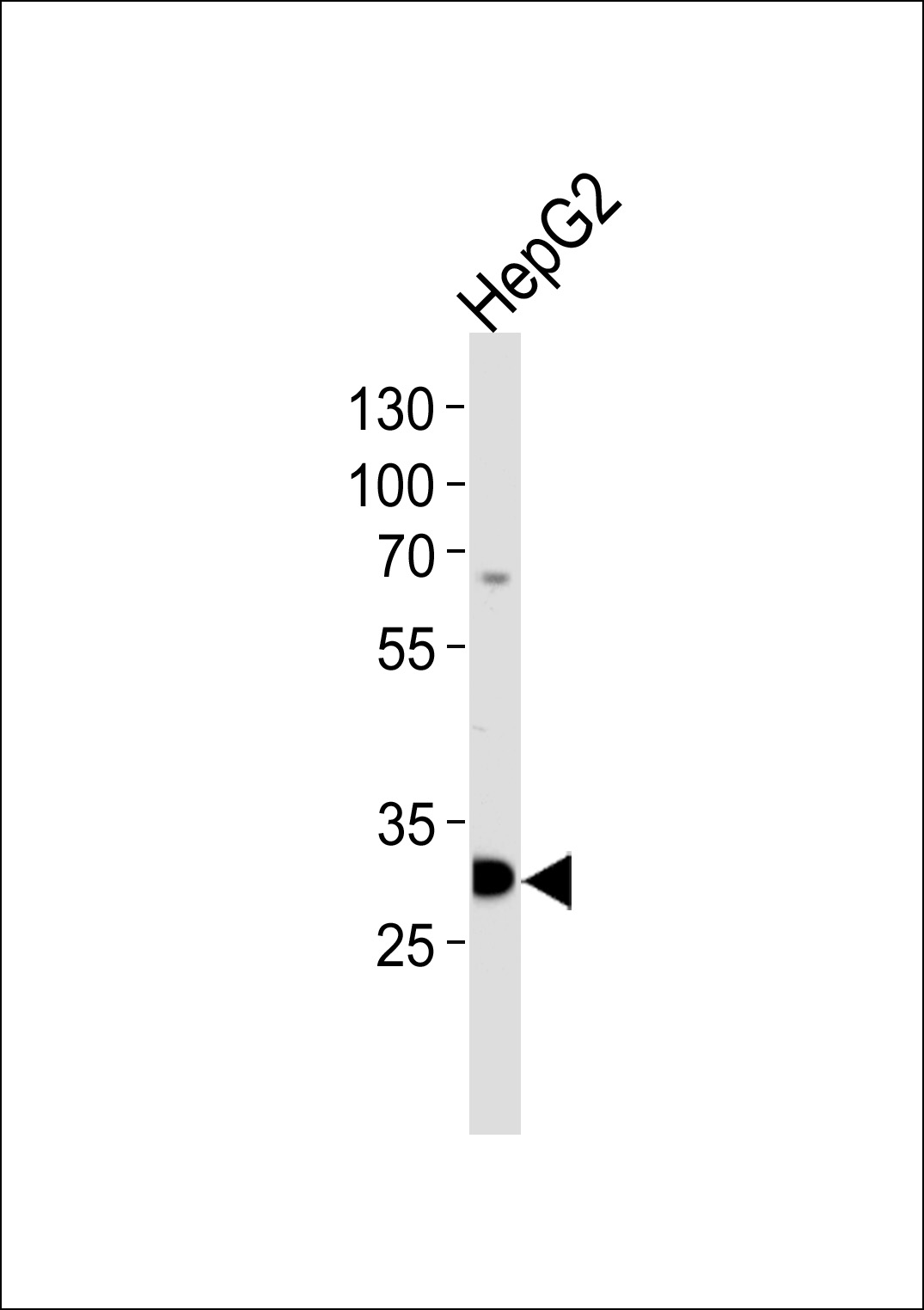 Rabbit Polyclonal Antibody to PSME2