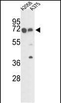Rabbit Polyclonal Antibody to FKBP10