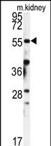 Rabbit Polyclonal Antibody to FKBP9 (N-term)