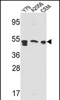 Rabbit Polyclonal Antibody to SAP (Center E300)