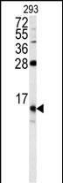 Rabbit Polyclonal Antibody to FKBP1B (N-term)