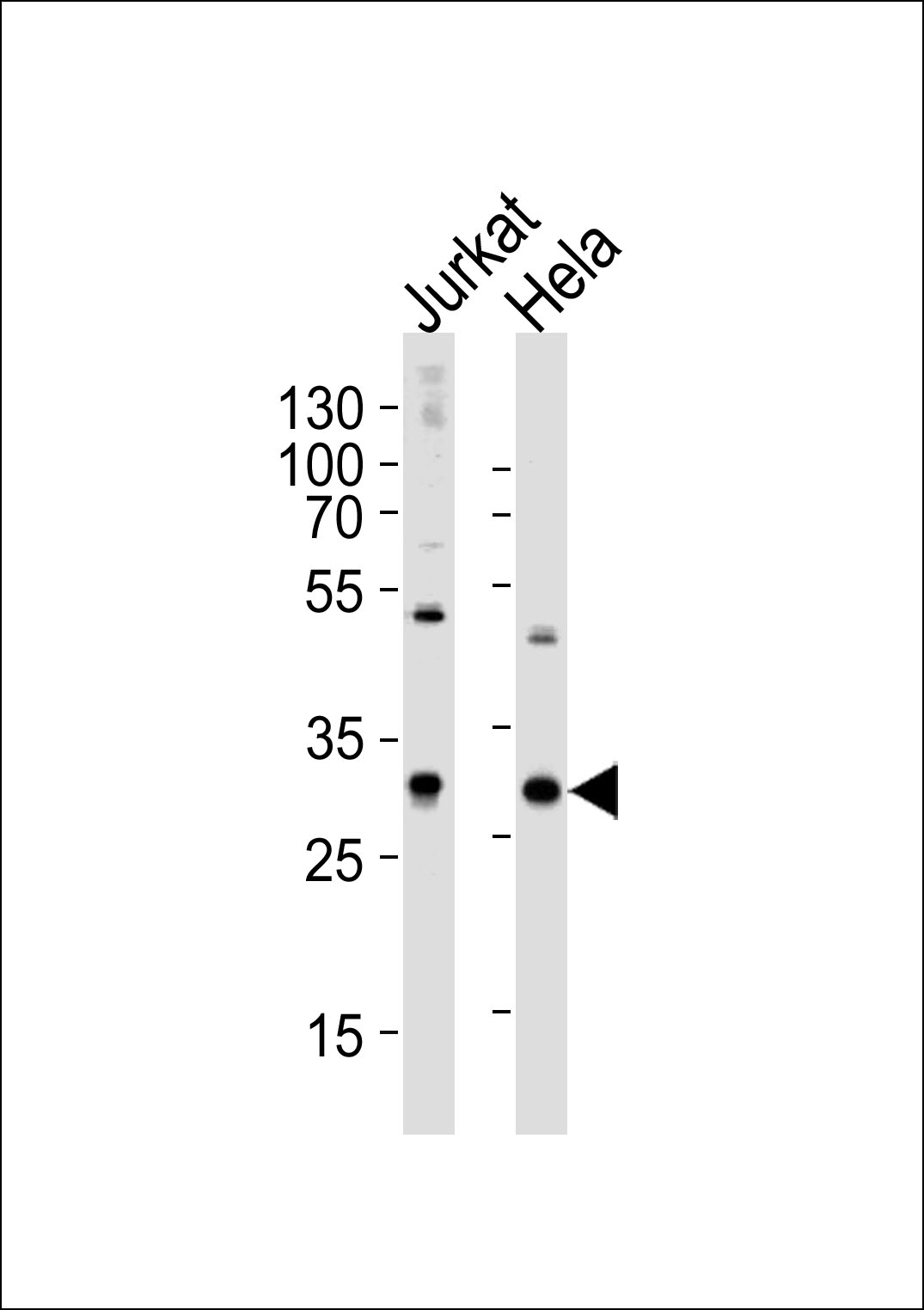 Rabbit Polyclonal Antibody to CAPZB (N-term)