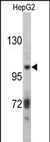 Rabbit Polyclonal Antibody to ITIH2