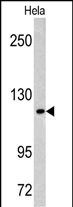 Rabbit Polyclonal Antibody to MAML3