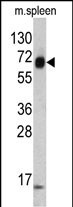 Rabbit Polyclonal Antibody to KRT4