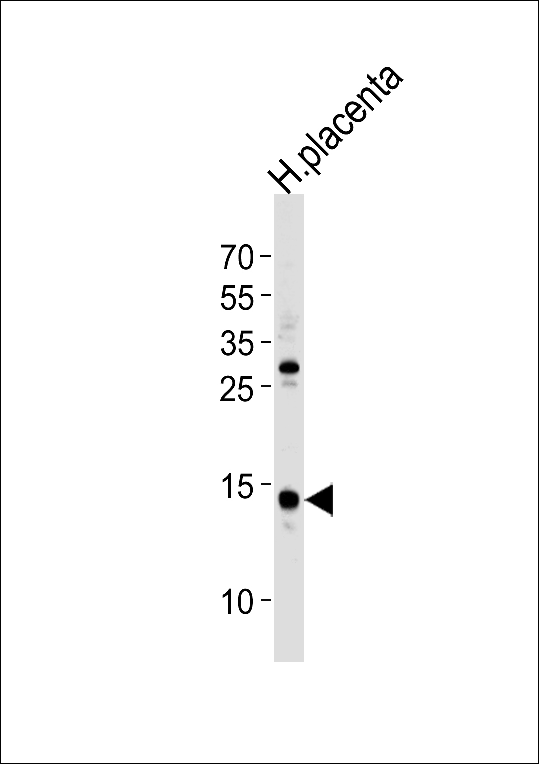 Rabbit Polyclonal Antibody to FKBP2 (N-term)