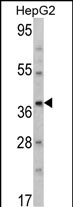 Rabbit Polyclonal Antibody to AMT (N-term)