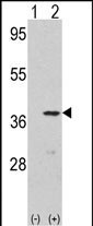 Rabbit Polyclonal Antibody to CDK3 (N-term Y19)