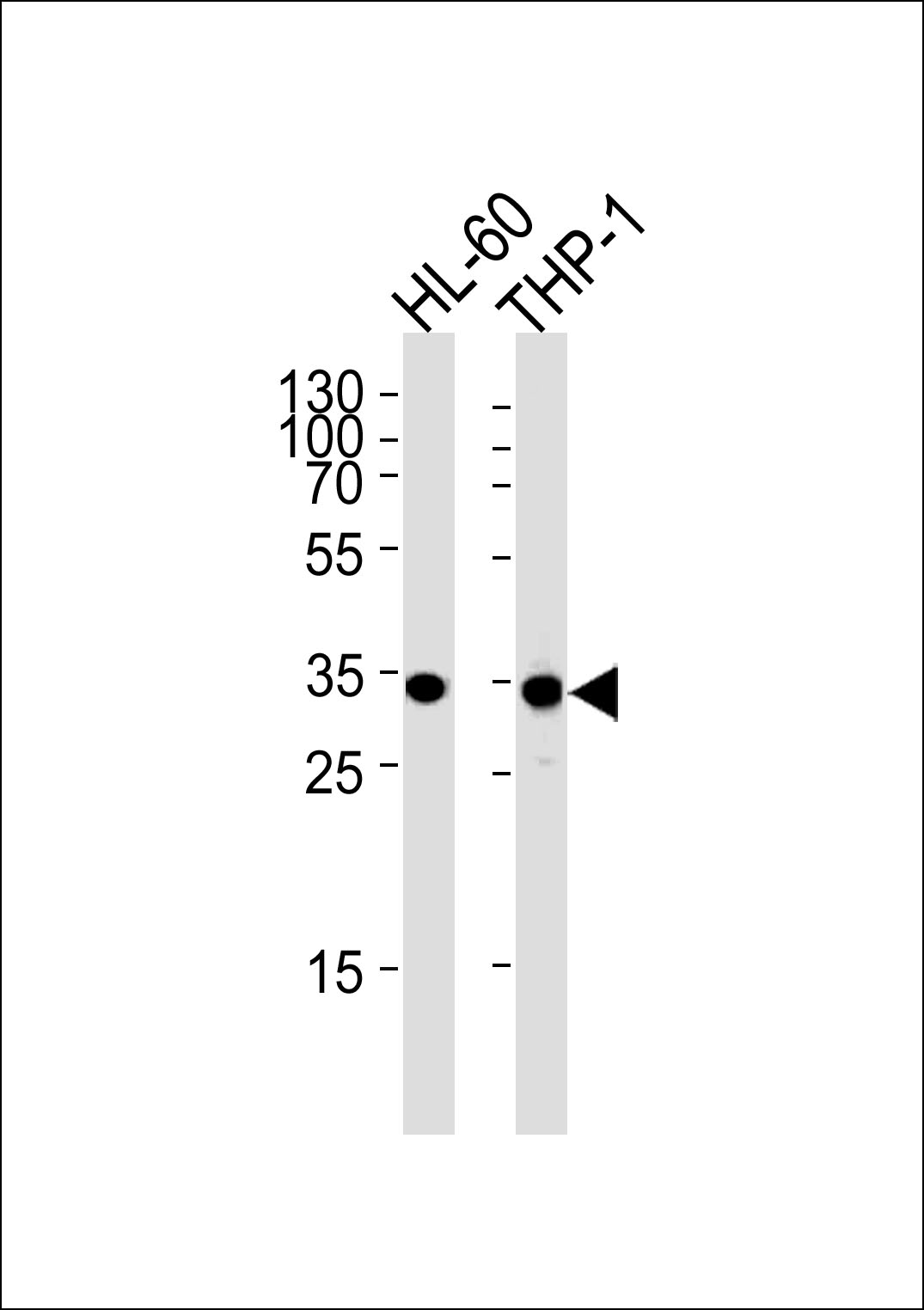 Rabbit Polyclonal Antibody to MDH1