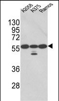 Rabbit Polyclonal Antibody to PDIA3