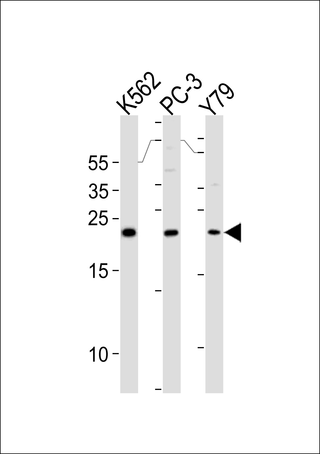 Rabbit Polyclonal Antibody to GSTP1