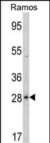 Rabbit Polyclonal Antibody to PGLS