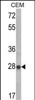 Rabbit Polyclonal Antibody to IGFBP6