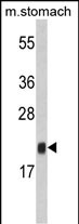 Rabbit Polyclonal Antibody to FKBP11 (N-term)