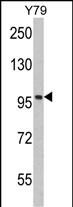 Rabbit Polyclonal Antibody to KPNB1 (N-term)