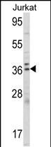 Rabbit Polyclonal Antibody to ALAD