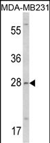 Rabbit Polyclonal Antibody to COLEC11 (N-term)