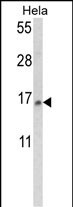 Rabbit Polyclonal Antibody to SNRPD2 (N-term)