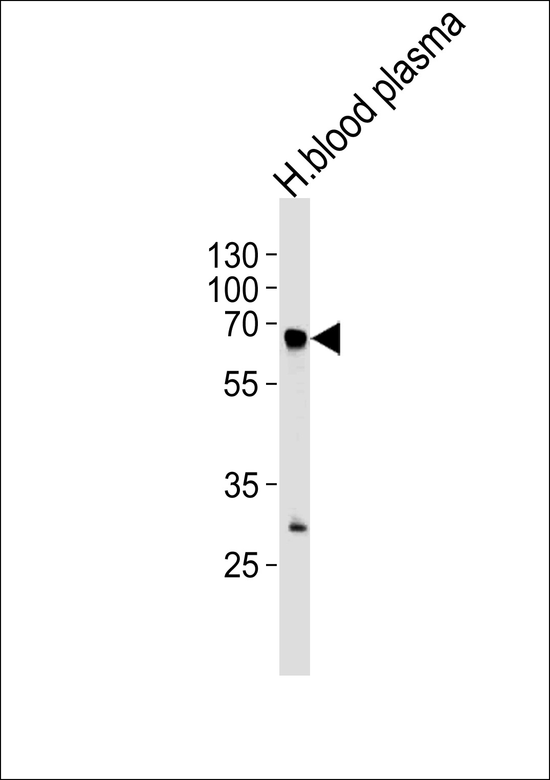 Rabbit Polyclonal Antibody to FGA (N-term)