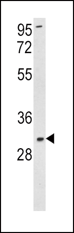 Rabbit Polyclonal Antibody to SOD3 (N-term)