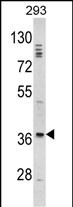 Rabbit Polyclonal Antibody to DLX2