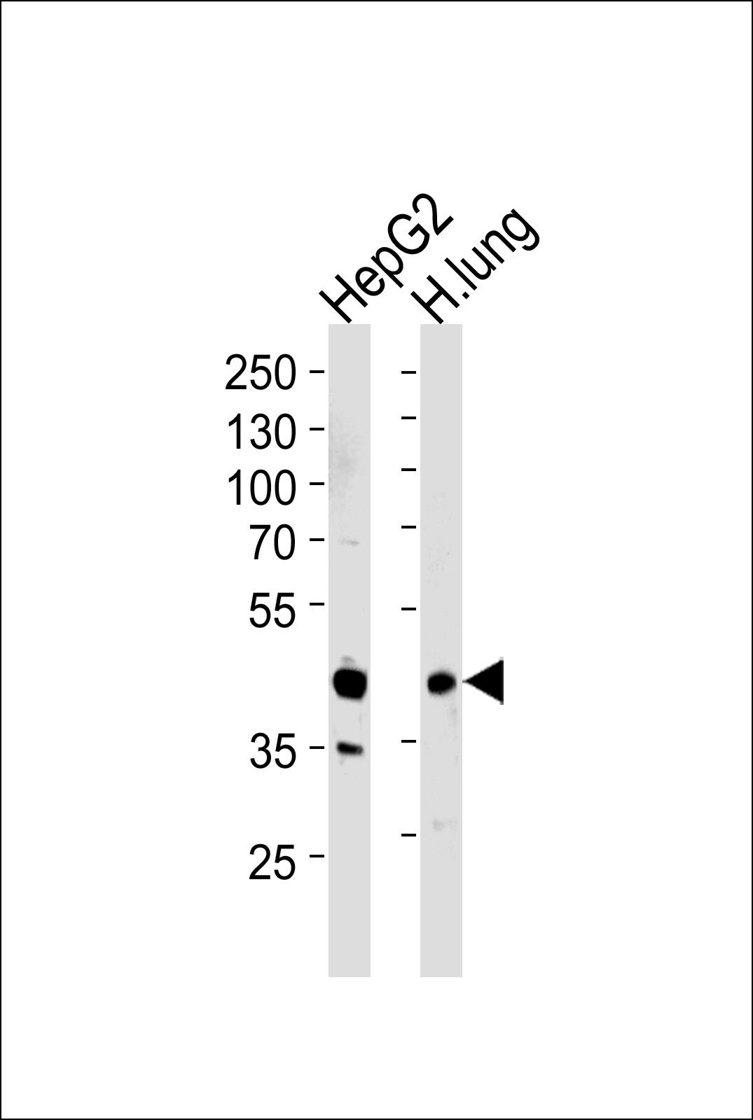 Rabbit Polyclonal Antibody to RAGE