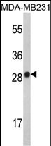 Rabbit Polyclonal Antibody to IL2