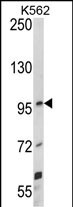 Rabbit Polyclonal Antibody to UNC5C