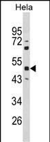 Rabbit Polyclonal Antibody to PAX6