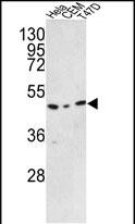 Rabbit Polyclonal Antibody to C9orf156