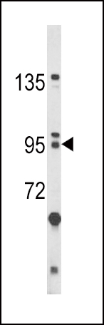 Rabbit Polyclonal Antibody to BICC1 (N-term)