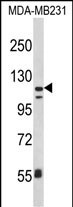 Rabbit Polyclonal Antibody to ITGAX