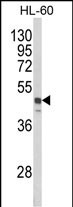 Rabbit Polyclonal Antibody to SNX6
