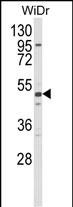 Rabbit Polyclonal Antibody to ALDH5A1