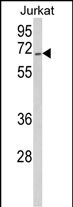Rabbit Polyclonal Antibody to RBM14