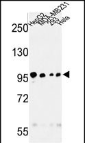 Rabbit Polyclonal Antibody to MASTL
