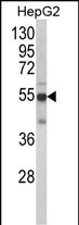 Rabbit Polyclonal Antibody to CYP2J2 (N-term)