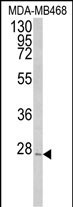 Rabbit Polyclonal Antibody to PEX11A (N-term)