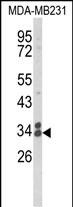 Rabbit Polyclonal Antibody to CLTA