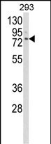 Rabbit Polyclonal Antibody to CLGN