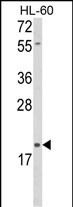 Rabbit Polyclonal Antibody to DLK2